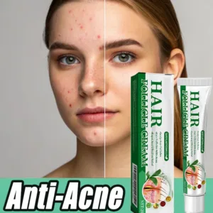 3RD Anti-Acne Cream Effective Removes Skin Nodules Pustules Cysts Papules Blackheads Men and Women Acne Skin Care Essence Cream
